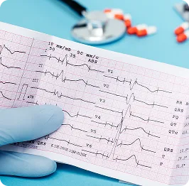 ECG heart monitoring test illustration